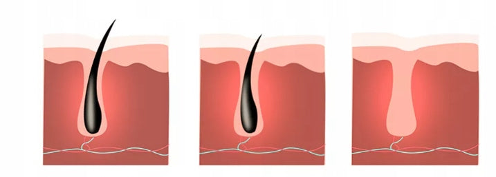 Fotoepoliatorius HEELLY IPL